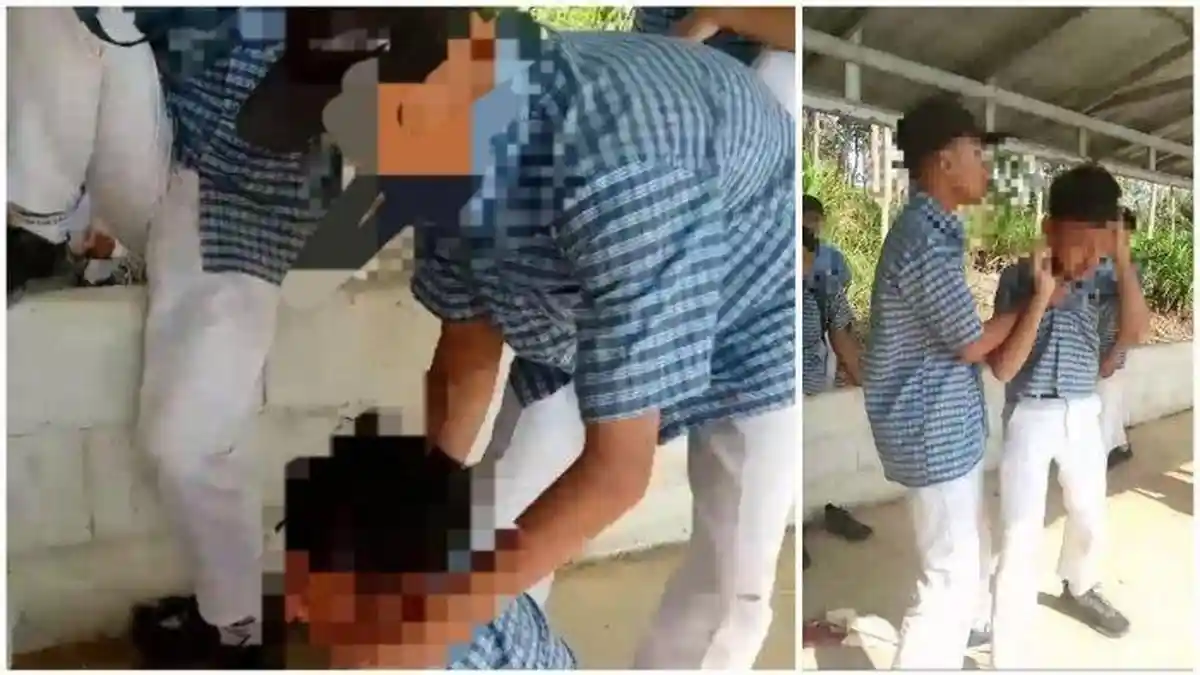 Kondisi Korban Bully di Cilacap Memilukan, Patah Tulang Rusuk, Polri Siap Bantu Biaya Pengobatan