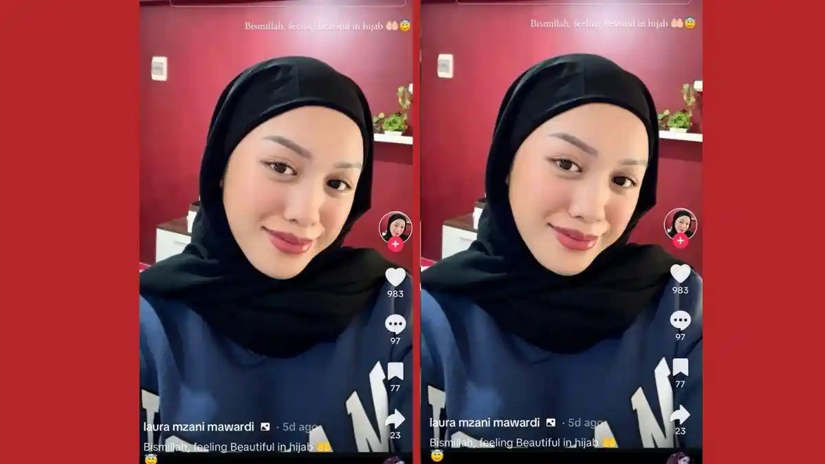 Apa Itu Visum yang Dilakukan Lolly Anak Nikita Mirzani?