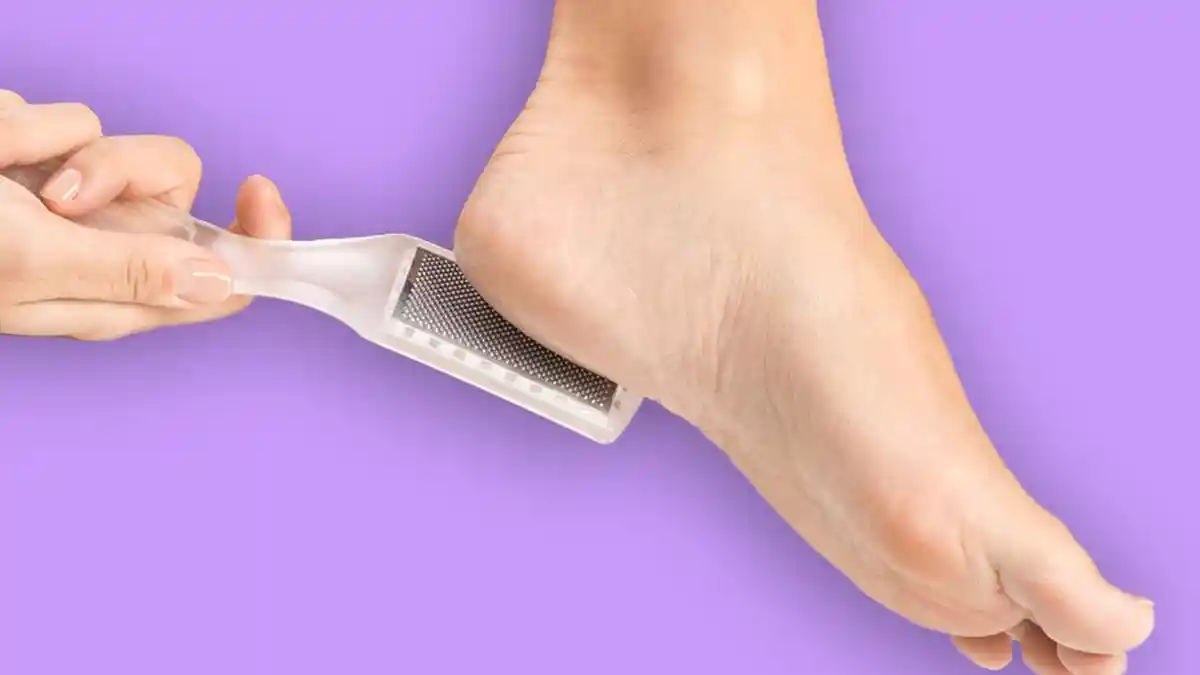Gunakan Bahan yang Mudah Ditemukan di Rumah, Ini 5 Tips Sederhana Hilangkan Kapalan di Kaki