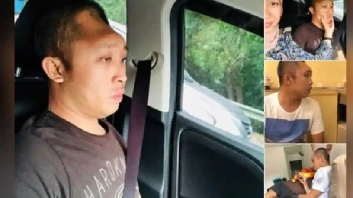 Setengah Tempurung Kepala Pria Ini Terpaksa Diangkat, Sang Pacar Ungkapkan Kisah Tragis Dibaliknya