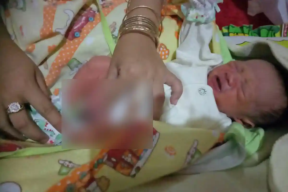Subhanallah! Ajaib, Bayi Lahir Sudah Terkhitan, Tonton Videonya