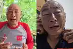 Heru-Gundul-bagikan-potret-wajahnya-dengan-kondisi-mata-yang-membengkak-dan.jpg