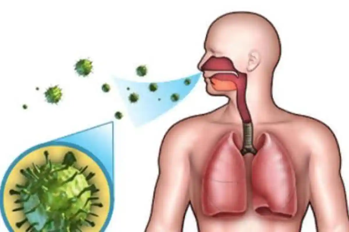 Penjelasan Pakar Penyakit Dalam Spesialis Paru FKKMK UGM soal Virus Corona