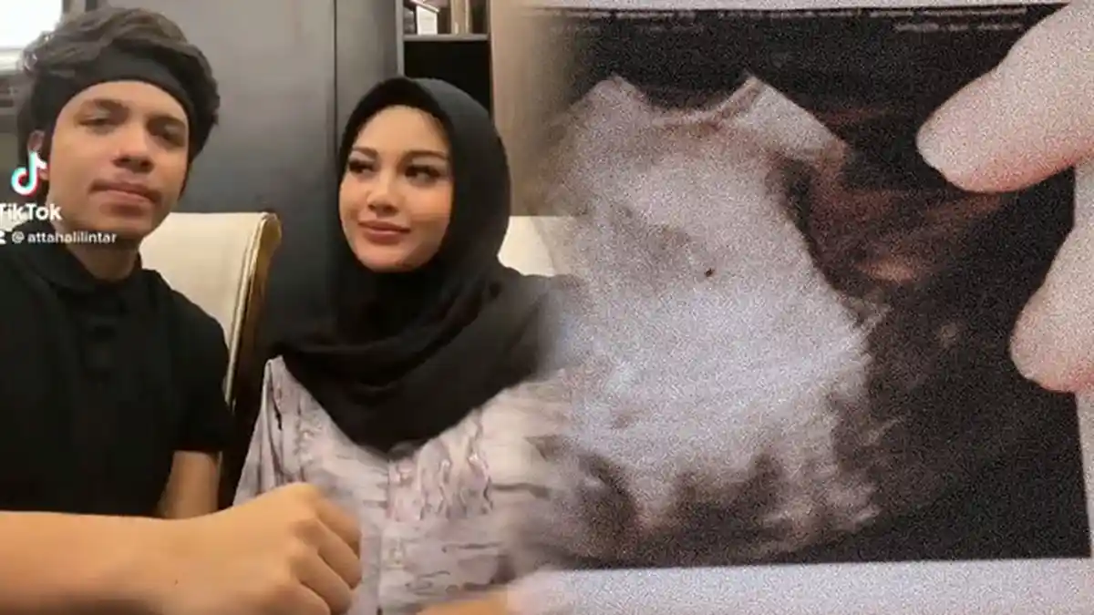Pesan Atta Halilintar untuk Aurel Hermansyah setelah Keguguran