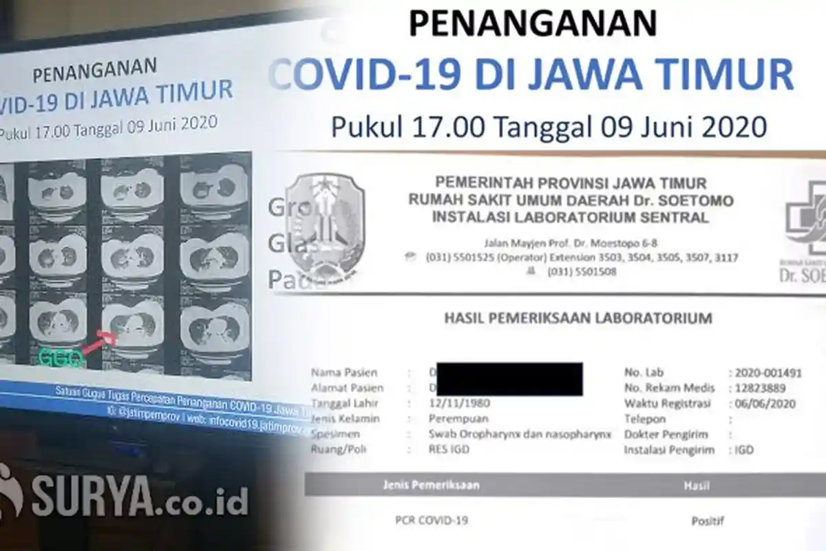 Gugus Tugas Tunjukkan Hasil PCR Ojol Wanita Korban Jambret di Surabaya, Dipastikan Positif Covid-19