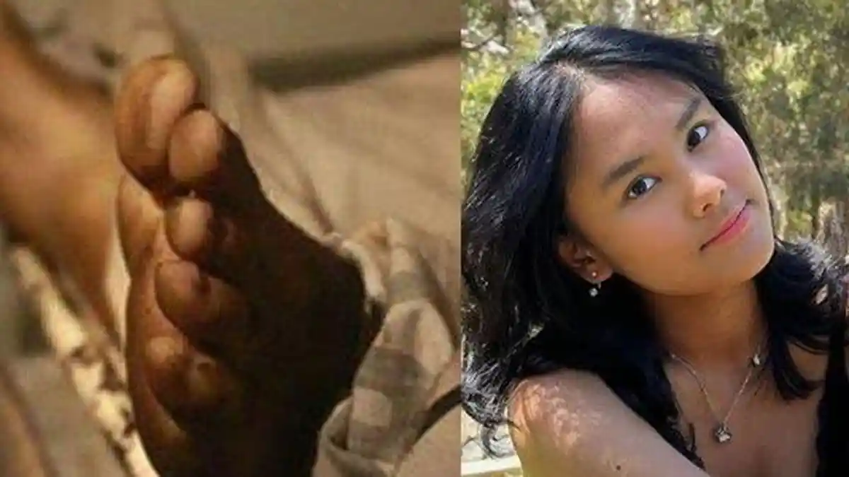 KRONOLOGI Alifia Soeryo Mahasiswi Asal Indonesia Meninggal Tertimpa Pohon di Australia