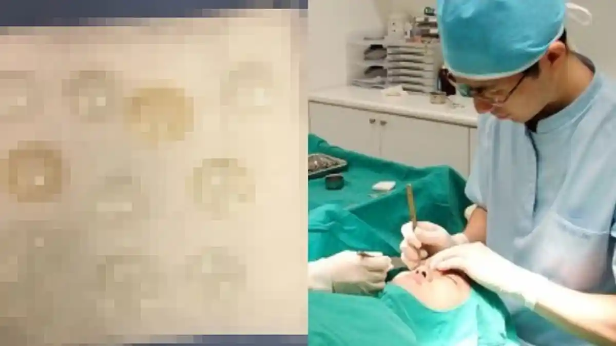 Ini Dampak Mengerikan Jika Tak Melepas Lensa Kontak atau Softlens Sebelum Tidur