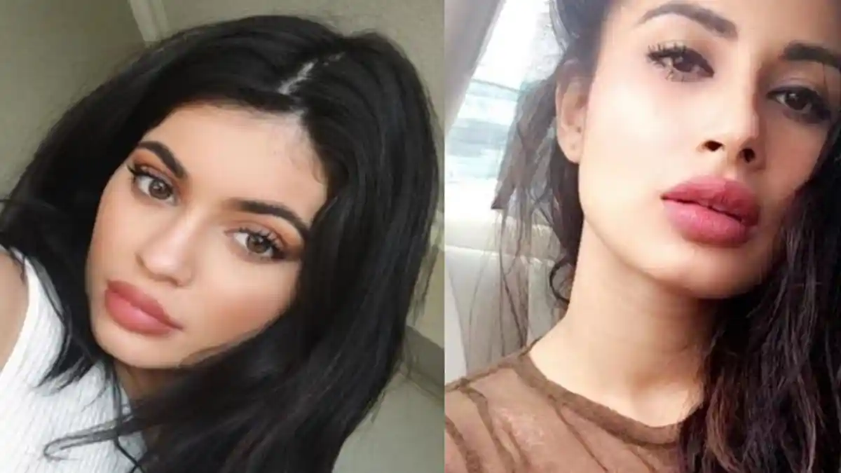 Bibir Seksi Hasil Otak-atik Lip Filler Memang Memukau, Diduga Juga Dilakukan Artis Ini