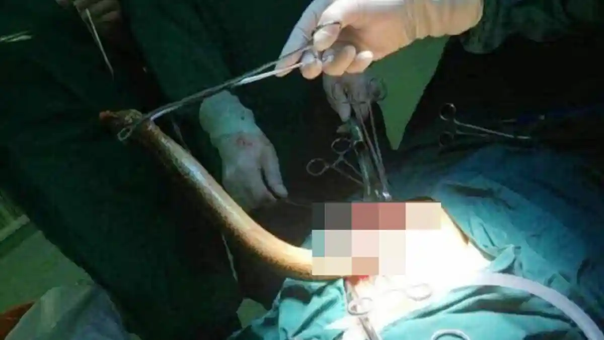 Ingin Tenar Gadis Ini Live Streaming Masukan Belut ke Miss V, Kejadian Selanjutnya Bikin Ngilu