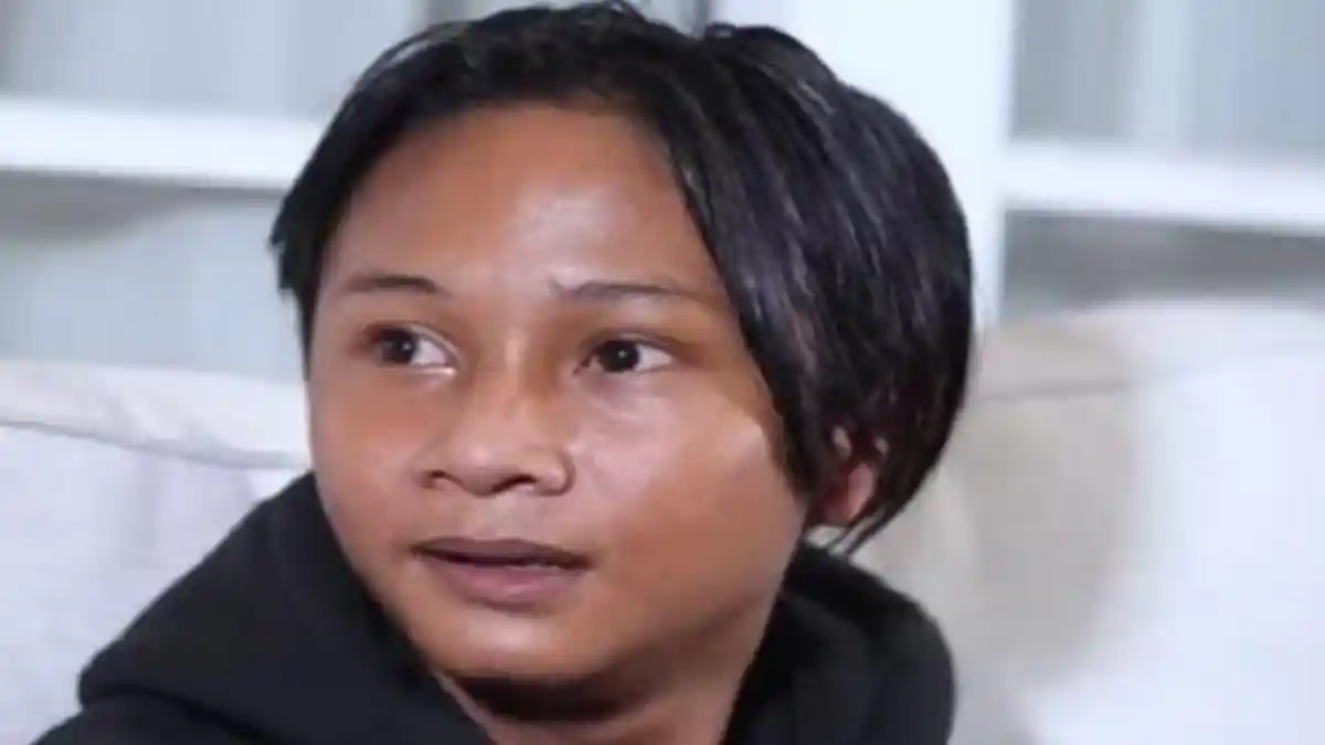 Tragis Kondisi  Fajar Sadboy Usai Kecelakaan Motor, Alami Luka Serius, Amanda Manopo Minta Doa