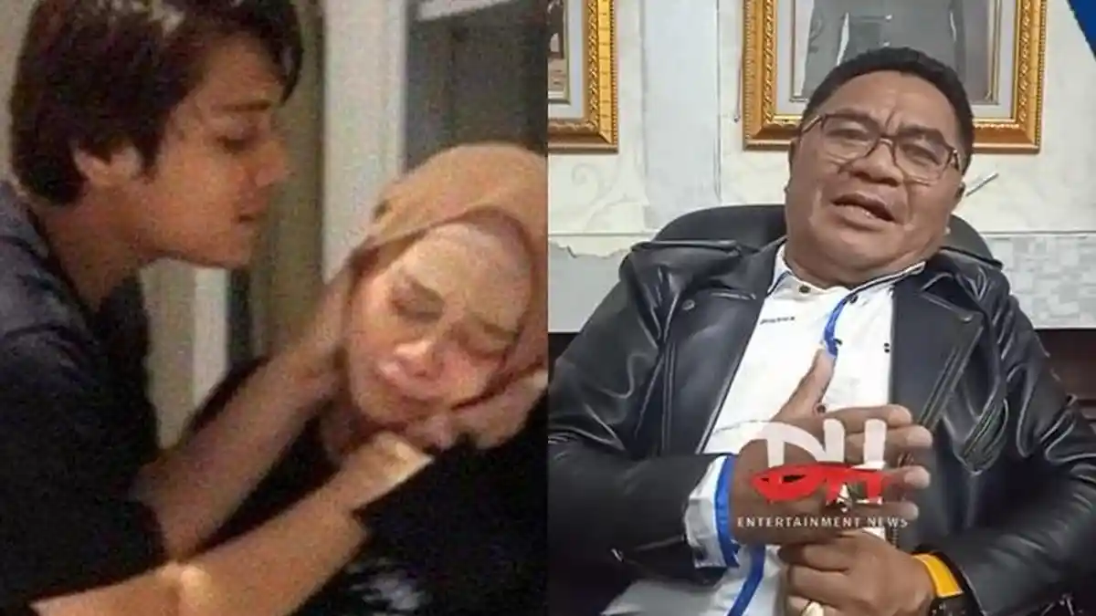 Rizky Billar KDRT Lesti, Pakar Hukum Sentil Kuasa Hukum Billar: Dianggap Remeh, Ini Kasus Serius