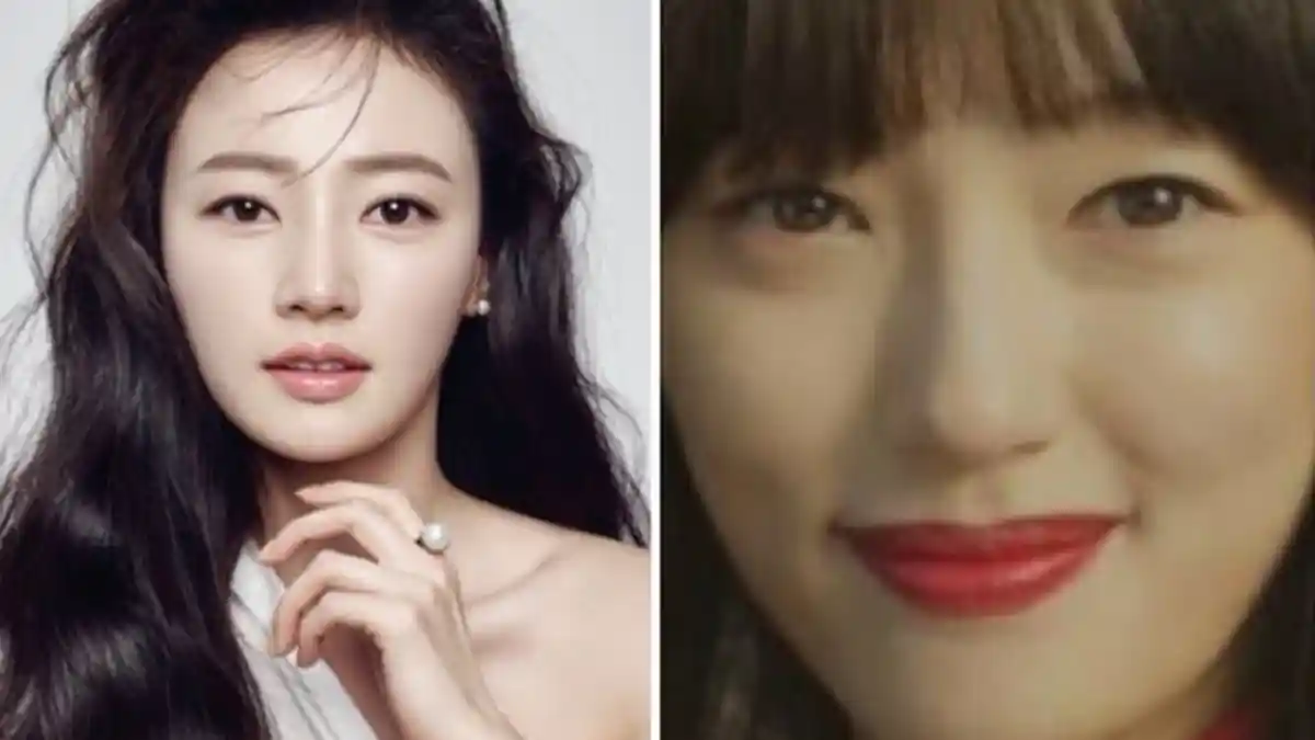 Ingin Lakukan Operasi Plastik, Artis Korea Ini Justru Ditolak Dokter