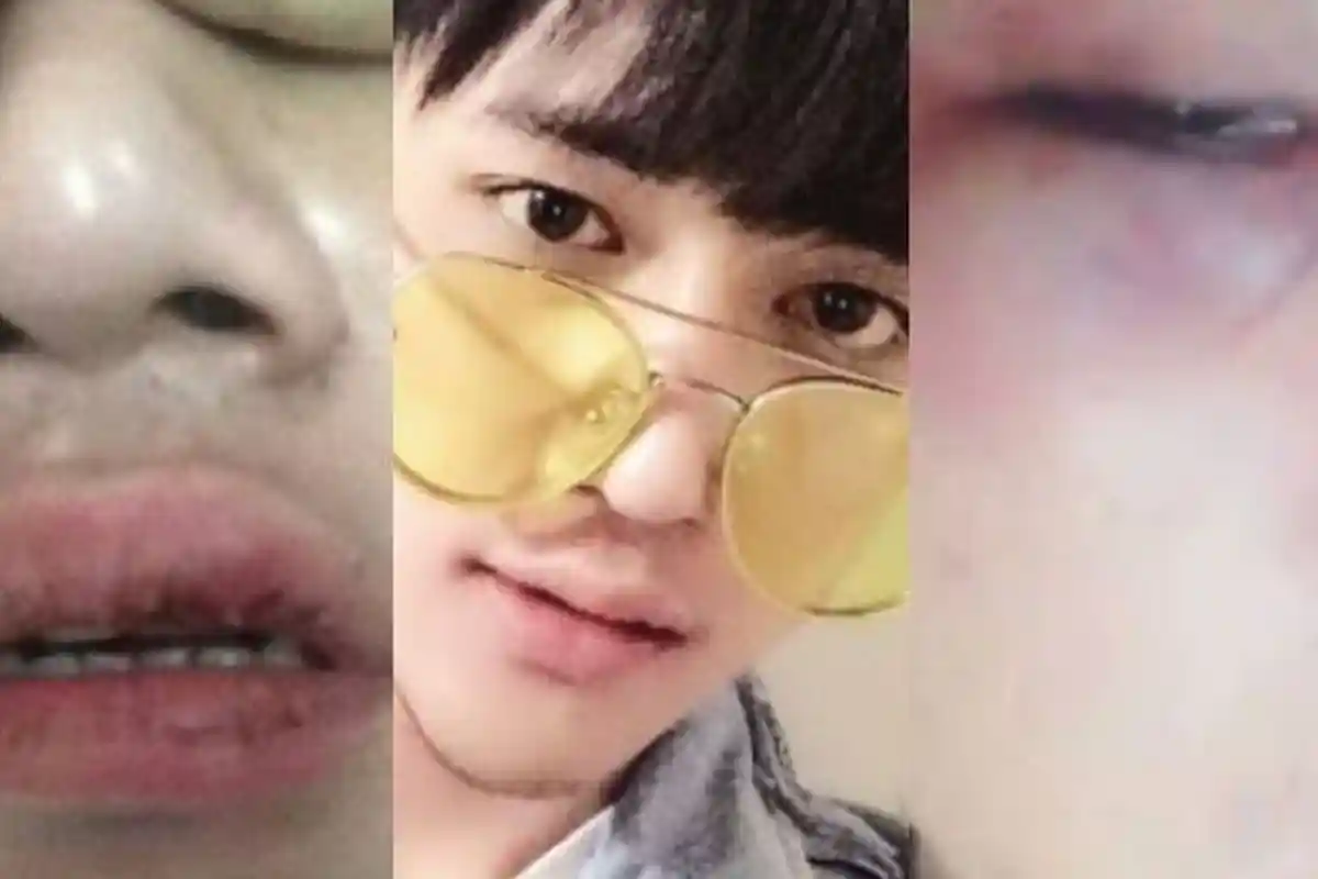 Dicky, Anggota Boy Band Smash Diejek 