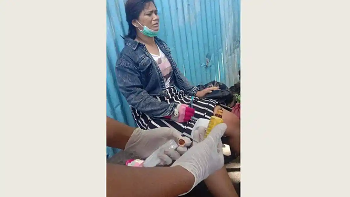 Kecelakaan di Ubung Denpasar, Dua Orang Jadi Korban