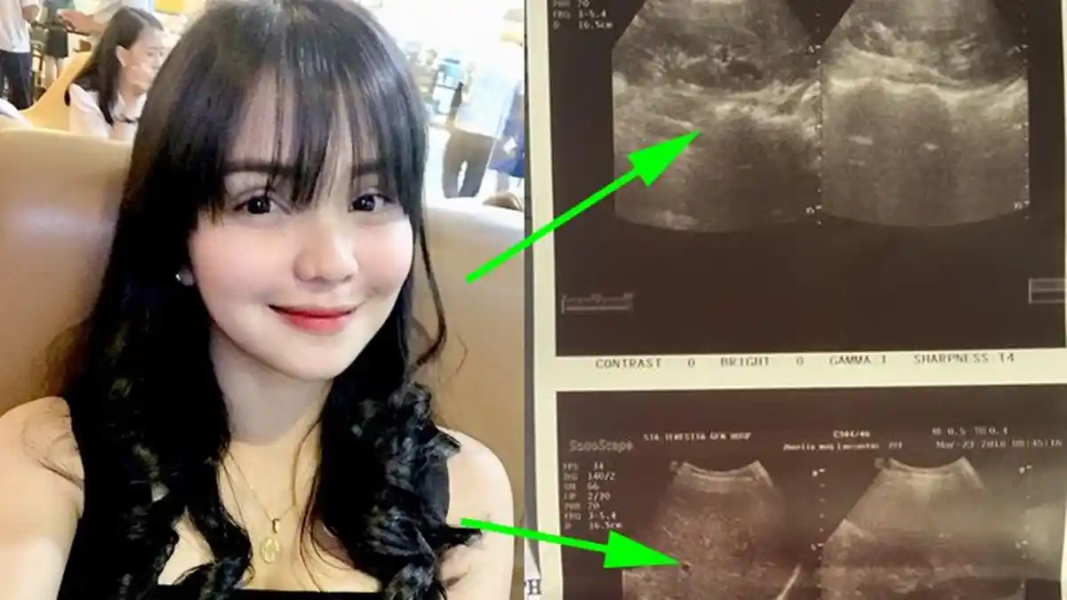 Gadis Ini Selalu Sakit Perut akibat Jarang Sarapan, Mau Muntah tapi Sulit, Ternyata Kondisinya Parah
