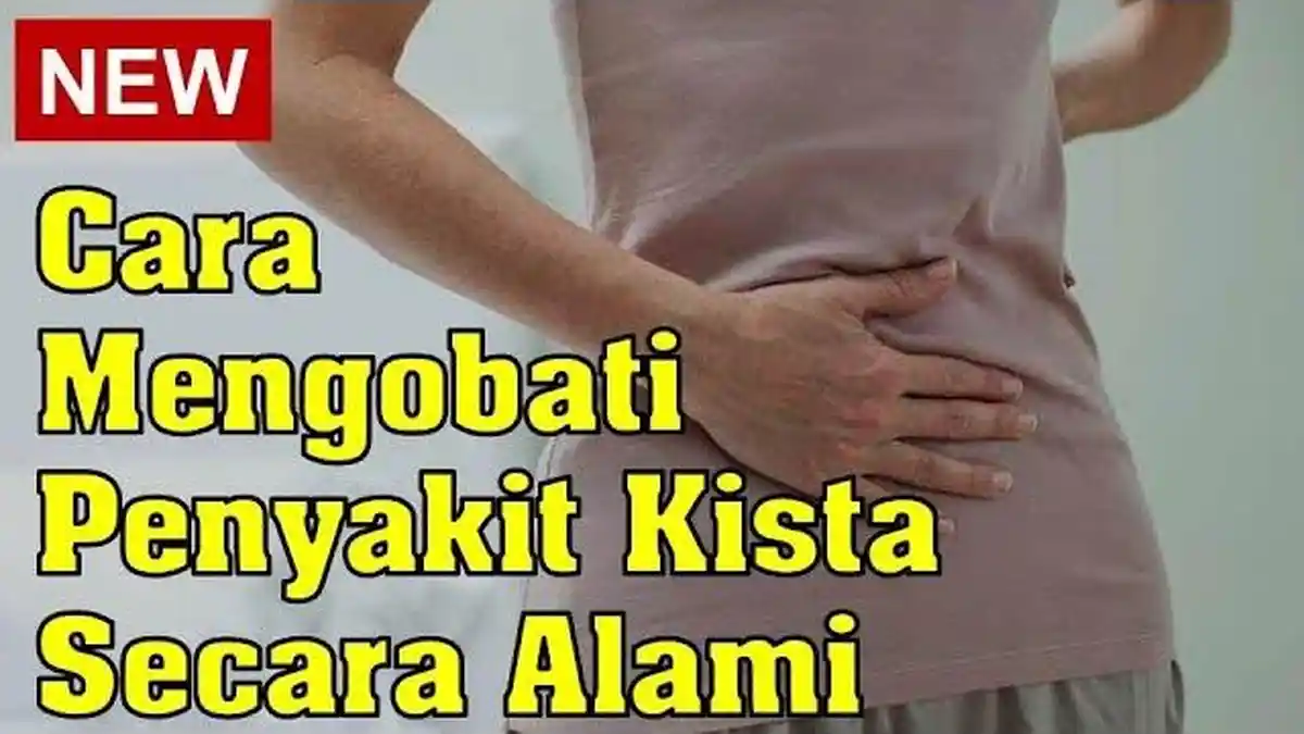 5 Cara Mudah dan Ampuh Untuk Menyembuhkan Penyakit Kista Tanpa Harus Pergi ke Dokter