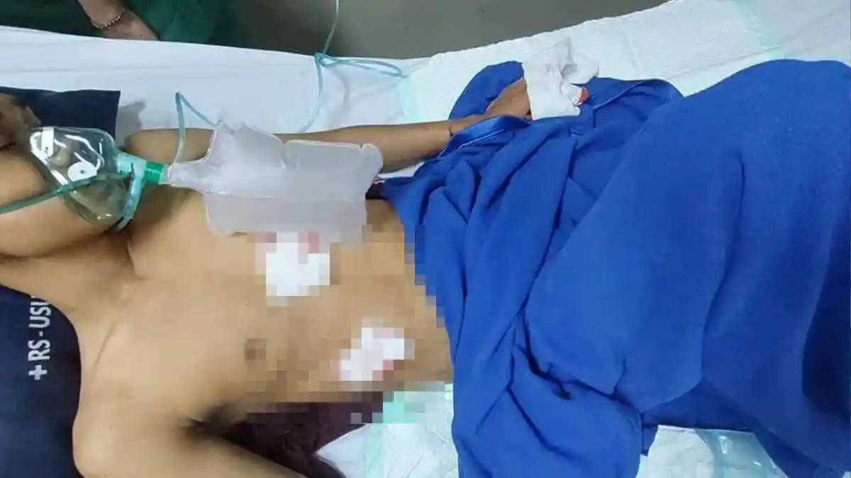 Brutalnya Begal di Kota Medan, Korban Kritis Tiga Hari, Kantung Empedu Pecah Ditikam Pelaku