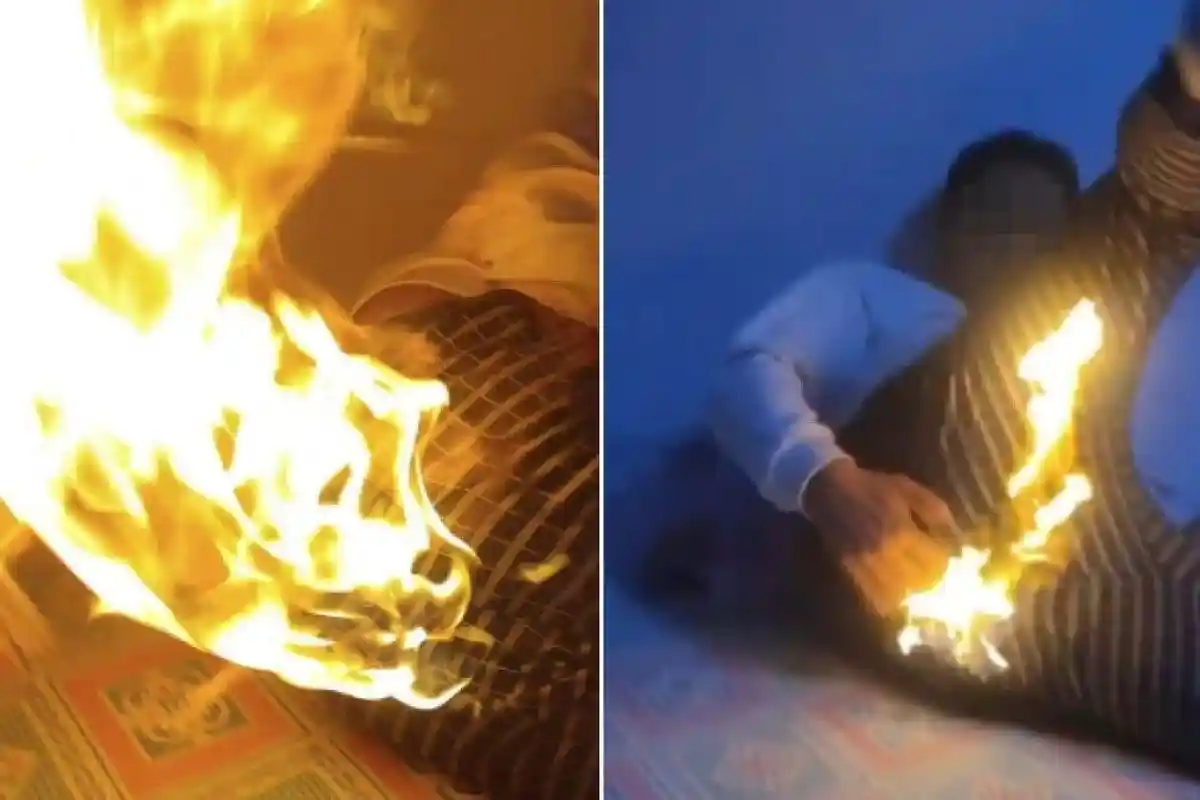 VIRAL Pantat Pria Nyaris Terbakar Gara-gara Kentut, Api Langsung Berkobar di Celana saat Buang Angin