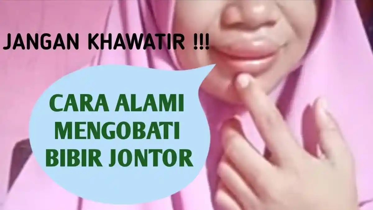 5 Cara Mengatasi Bibir Bengkak Digigit Semut Dengan Kompres, Berkumur Air Garam, Dijamin Sembuh
