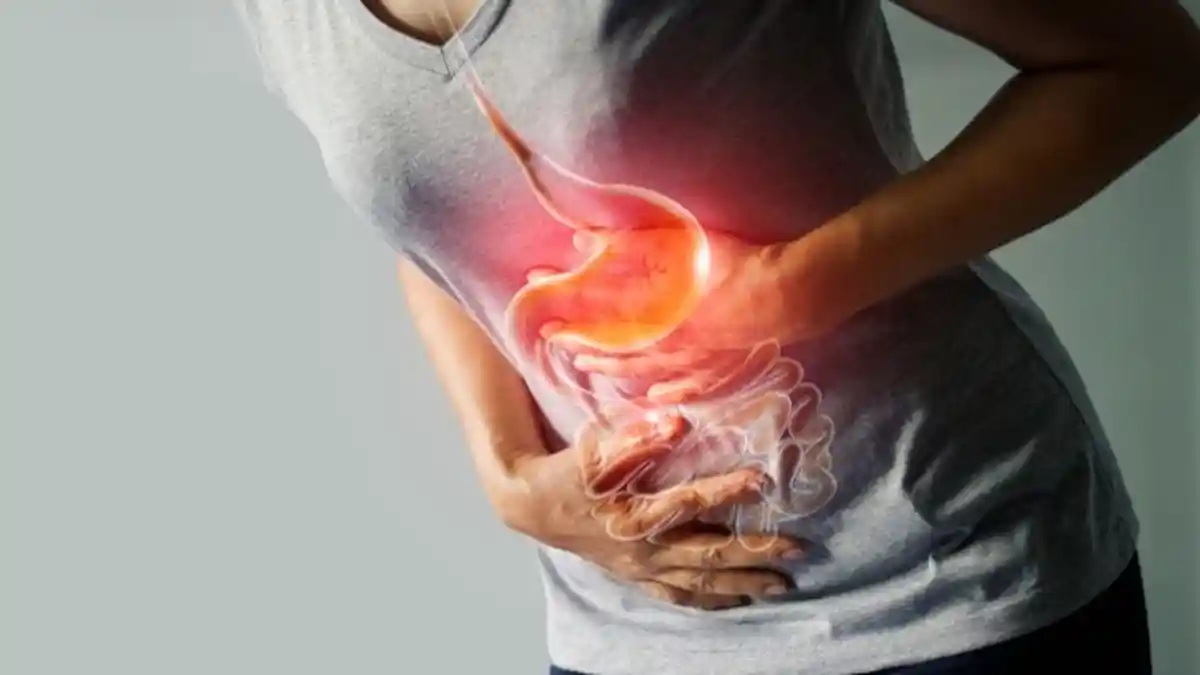 Begini Tips Meredakan Perut Panas dan Nyeri Akibat Naiknya Asam Lambung