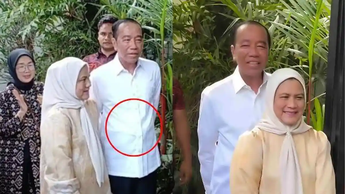 VIRAL Tonjolan di Perut Jokowi, Analisis Dokter Tifa Jawab Netizen: Pakai CAPD, Ini Sakit Berat