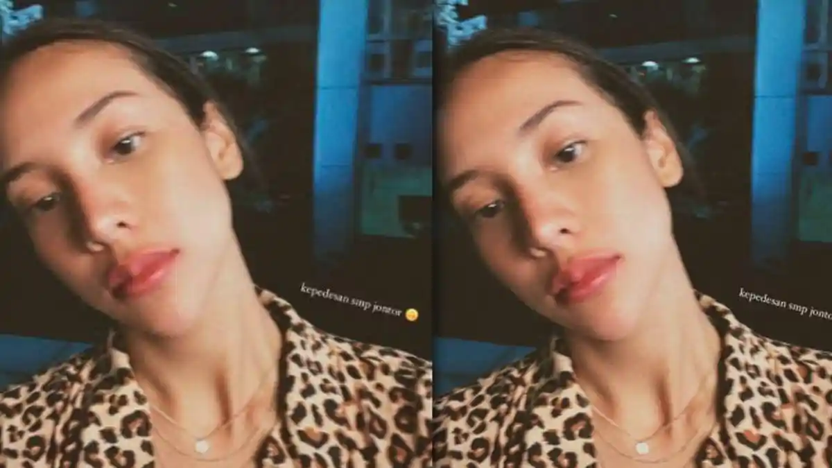 Bibir Anya Geraldine Jontor Saat Liburan Bareng Nadif Zahiruddin, Kenapa?