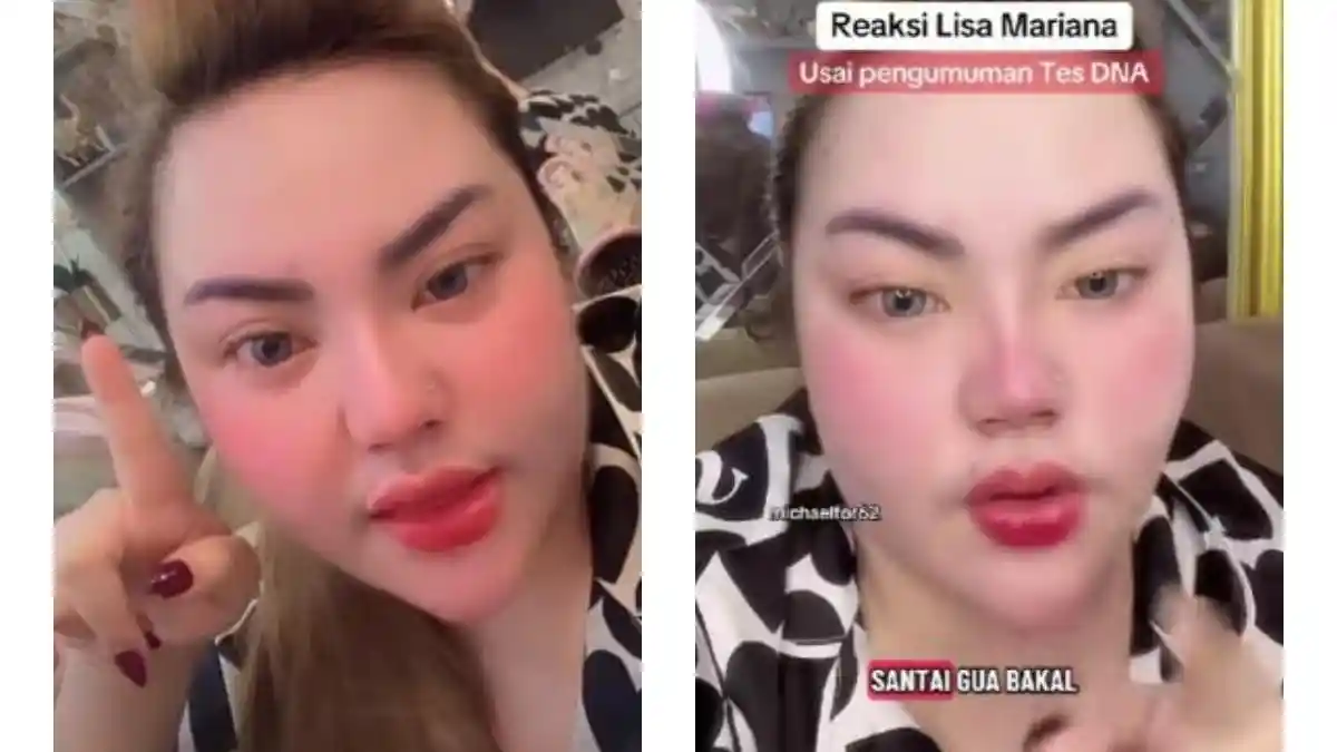 Lisa Mariana Nangis Minta Maaf ke Bu Cinta Istri Ridwan Kamil: Ini Dari Lubuk Hati