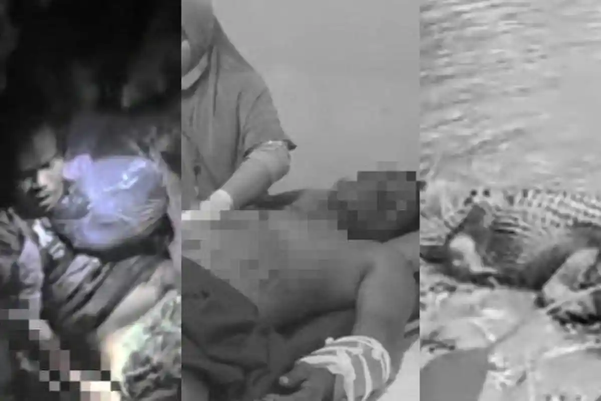 Diterkam Buaya saat Mancing, Warga Cibitung Pandeglang Berhasil Selamat