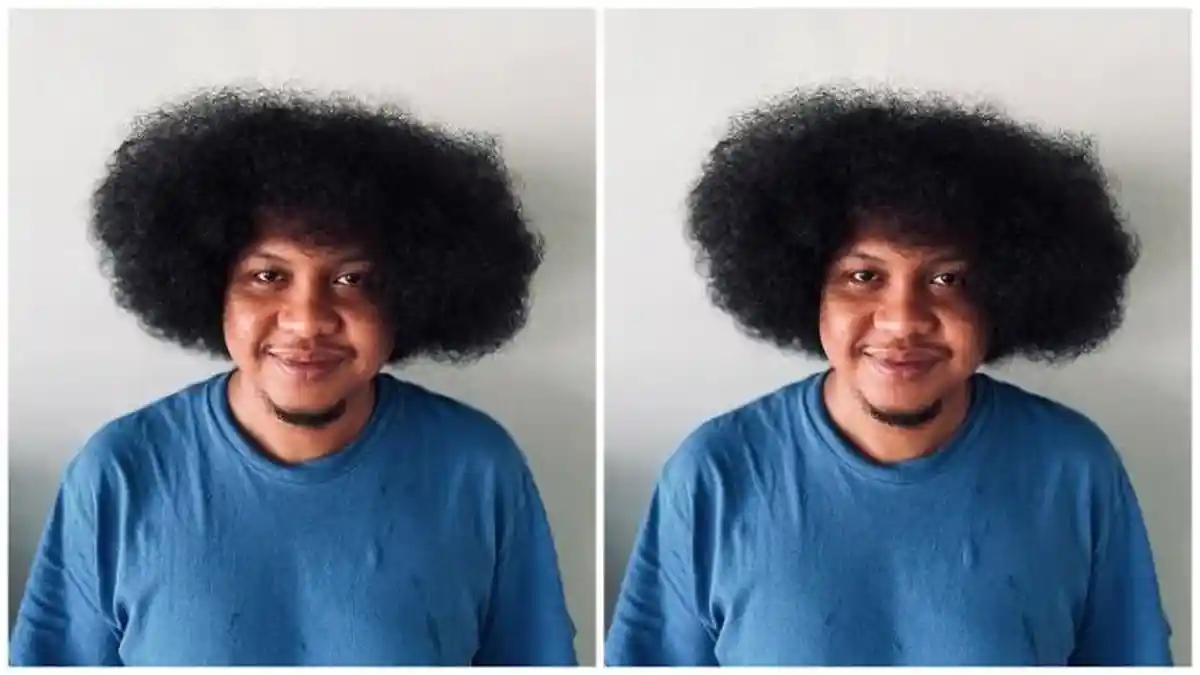 Babe Cabita Didiagnosis Anemia Aplastik, Berawal dari Gejala DBD, Kini Berobat ke Luar Negeri