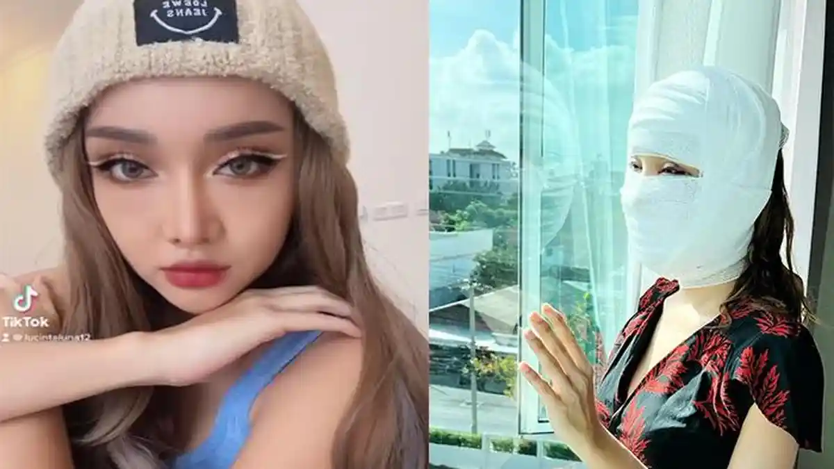 Dikenal Cantik setelah Operasi di Korea Selatan, Intip Wajah Lucinta Luna Tanpa Make Up