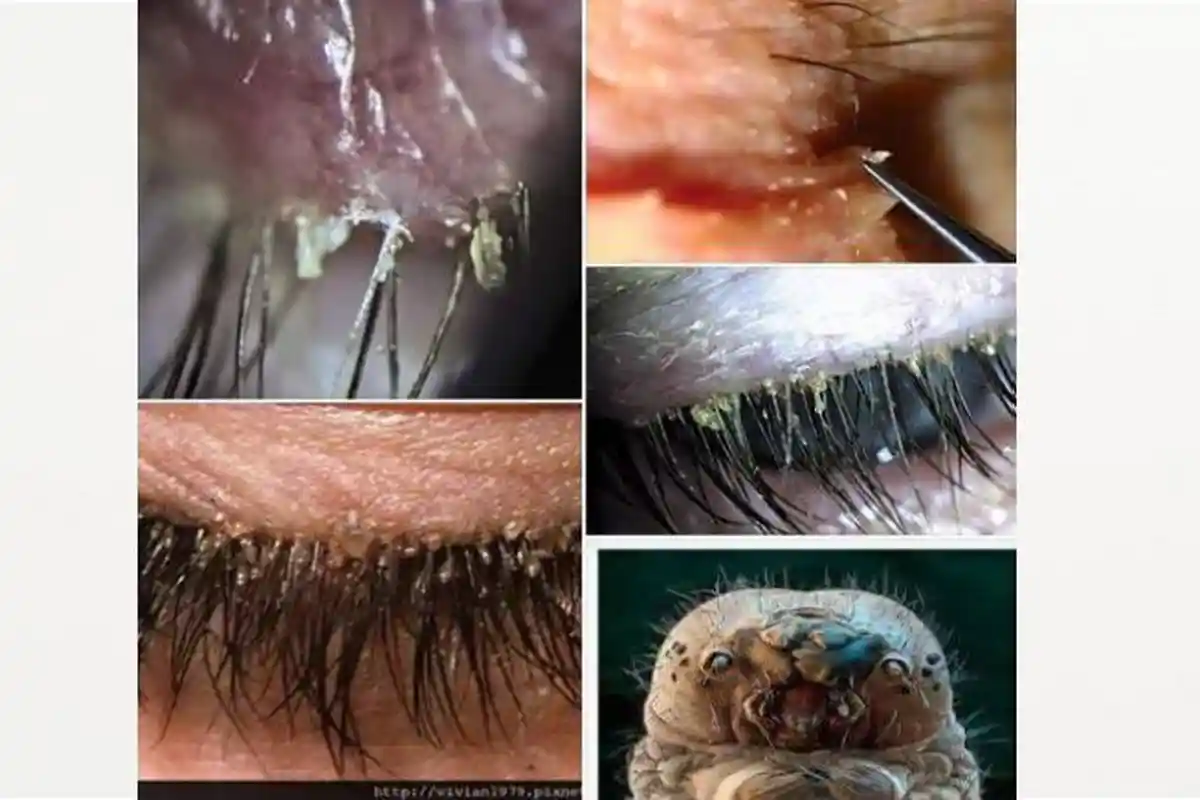 Smart Woman! Hati-hati Pakai Ekstensi Bulu Mata, Berisiko Infeksi