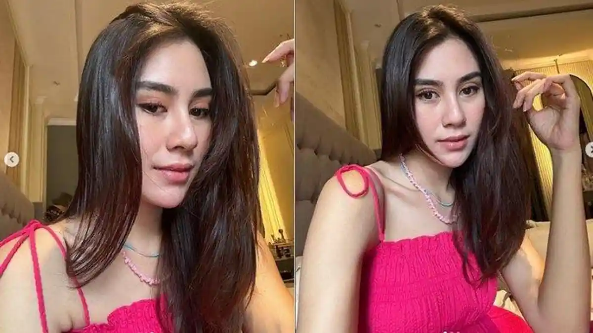 Syahnaz Sadiqah Diduga Operasi Plastik, Hidung & Bibir Jadi Sorotan, Berikut 7 Potret Terbaru Raffi