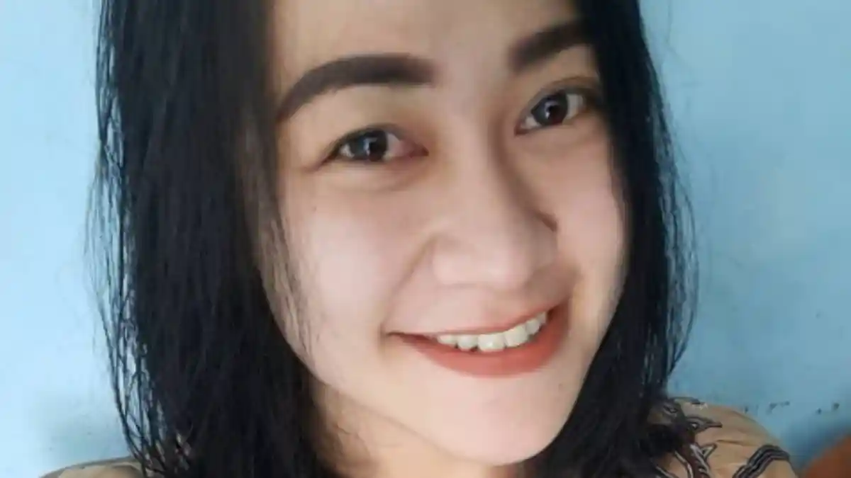Update Kasus Perawat Korban Pembakaran di Malang, Wajah Eva Sofiana Wijayanti Masih Bisa Pulih