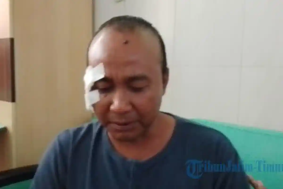 Detik-Detik Horor Jelang Kecelakaan Maut Bus Probolinggo, Saya Berpikir Pasti Mati