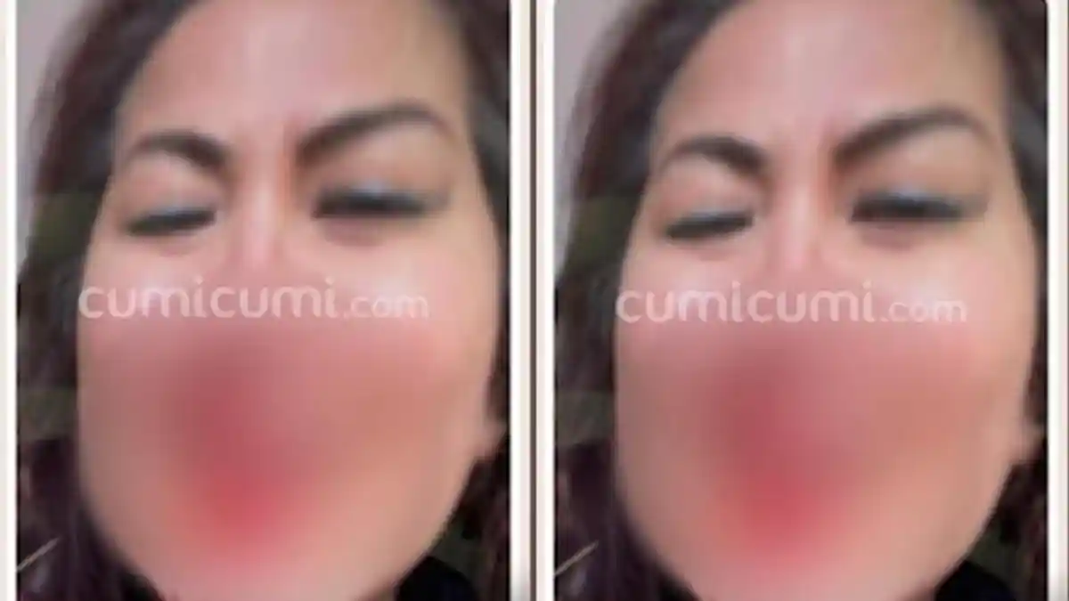 Beredar Foto Venna Melinda Menangis dengan Wajah sudah Berlumuran Darah, Akibat KDRT Suami?