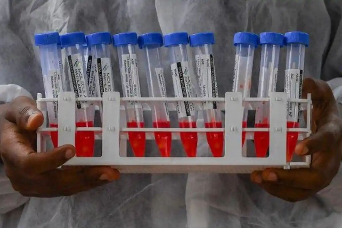 Projo Solo Minta Pemerintah Berantas Mafia PCR, Tak Ada yang Kebal Hukum Jika Memang Terbukti Salah