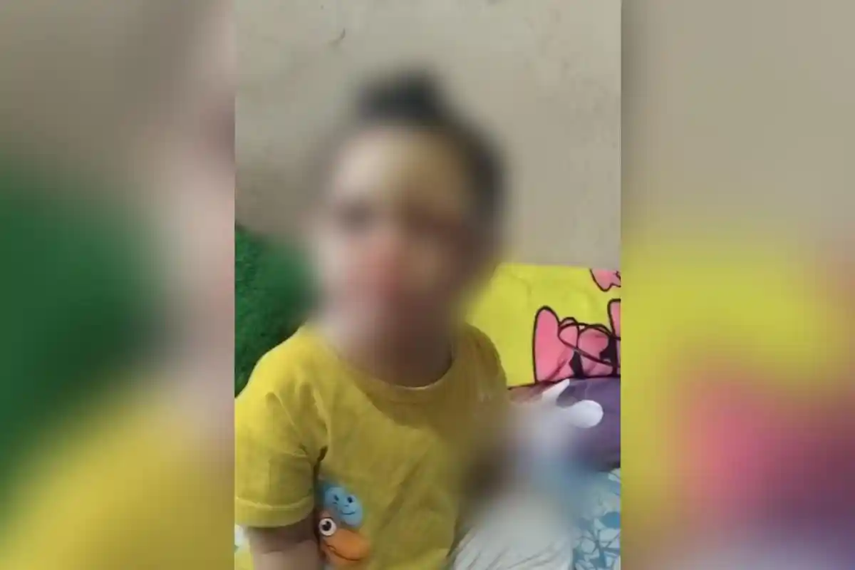 Viral di WA: Balita 2 Tahun di Garut Ditemukan dengan Retak Tulang & Wajah Bengkak, Diduga Dianiaya