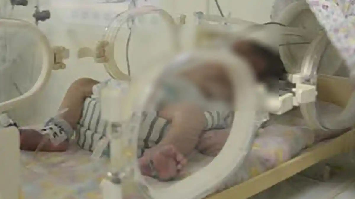 Begini Kondisi Terakhir Bayi yang Ditusuk Ibu Kandungnya di Mengwi