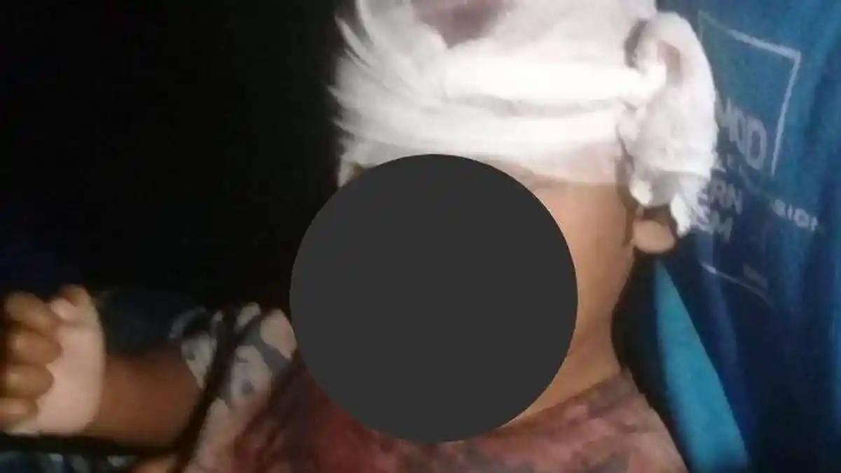 Tak Ditanggung BPJS, Nasib Bocah Korban Gempa Cianjur Pilu, Dirawat Ala Kadarnya oleh Rumah Sakit