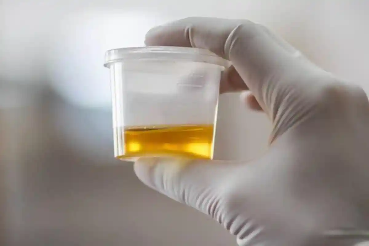 Oknum Polisi Gorontalo Positif Amfetamin, Kapolres Pohuwato Selidiki Riwayat Narkoba atau Obat Medis