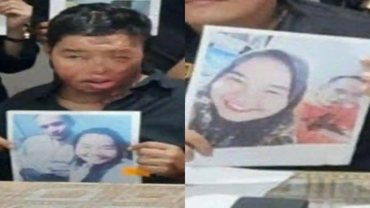 Sadis! Suami Siram Istri Pakai Air Keras, Korban Malah Dihantui Tagihan Rumah Sakit Rp357 Juta