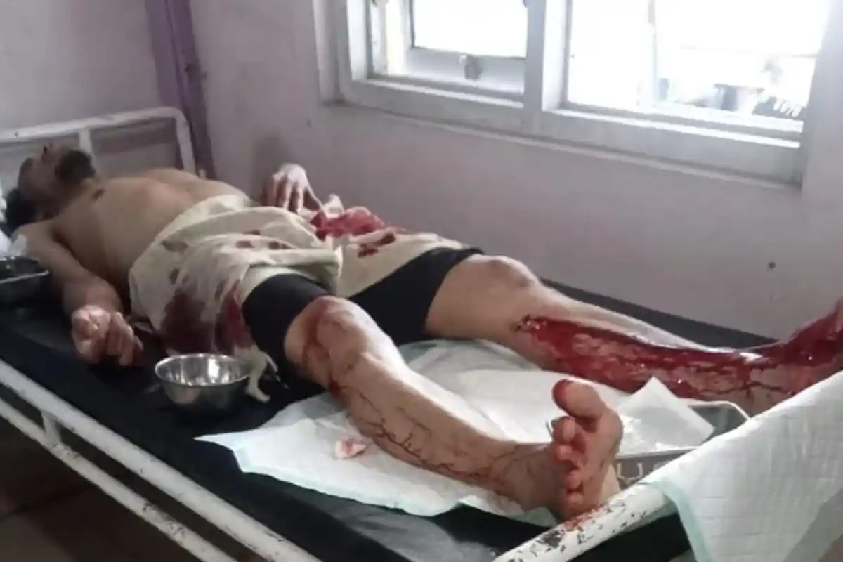 Teror Monyet di Situbondo, Satu Warga Luka Parah dan Dua Luka Ringan