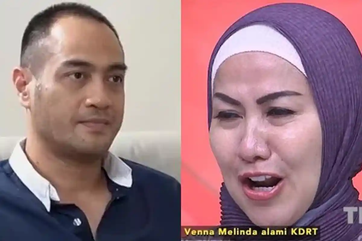 Malu tak Punya Pekerjaan jadi Alasan Ferry Irawan KDRT Venna Melinda, Ada Bukti Tulang Rusuk Patah