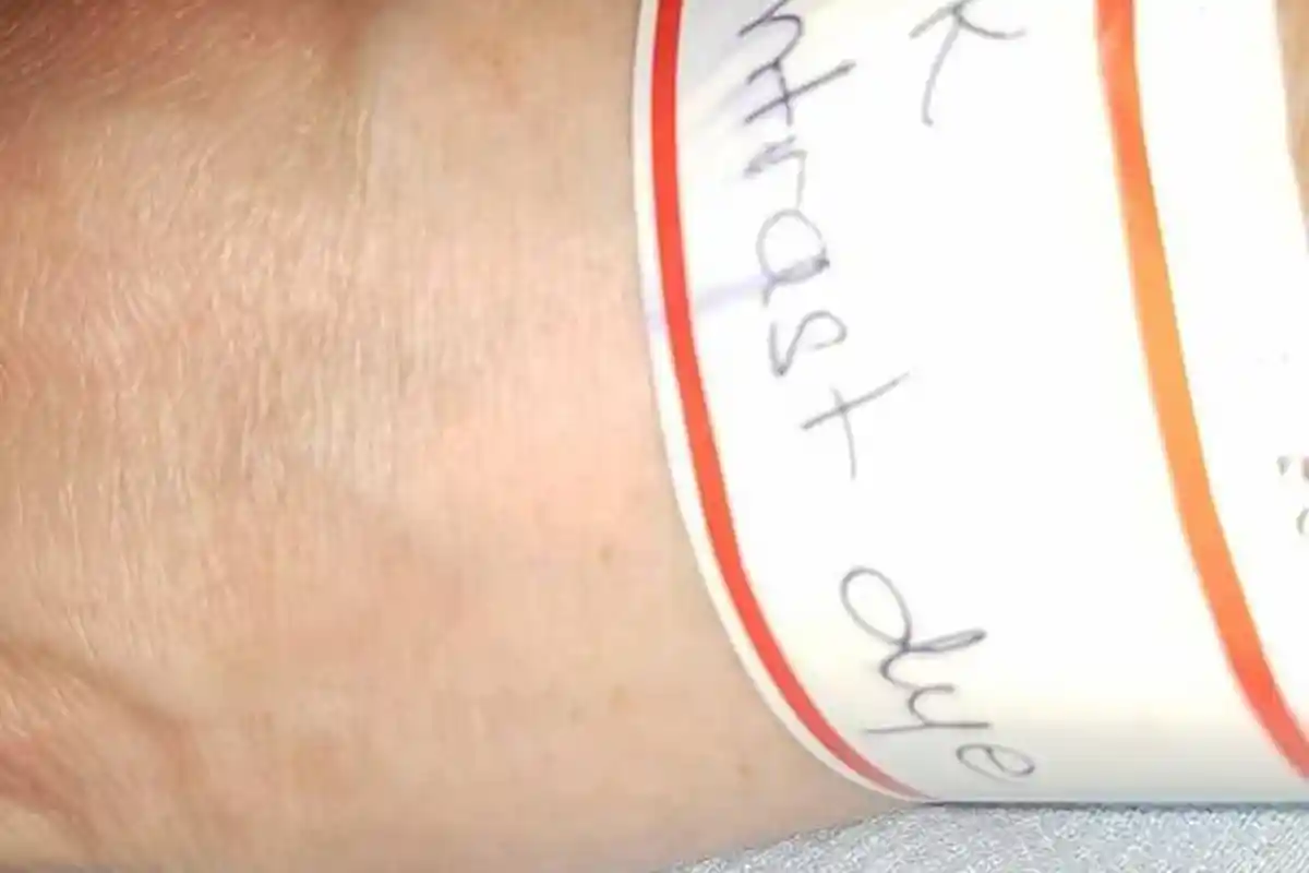 Kenali  4 Jenis Alergi Pada Anak dan  Ikuti Penjelasan dr. Reisa Broto Asmoro