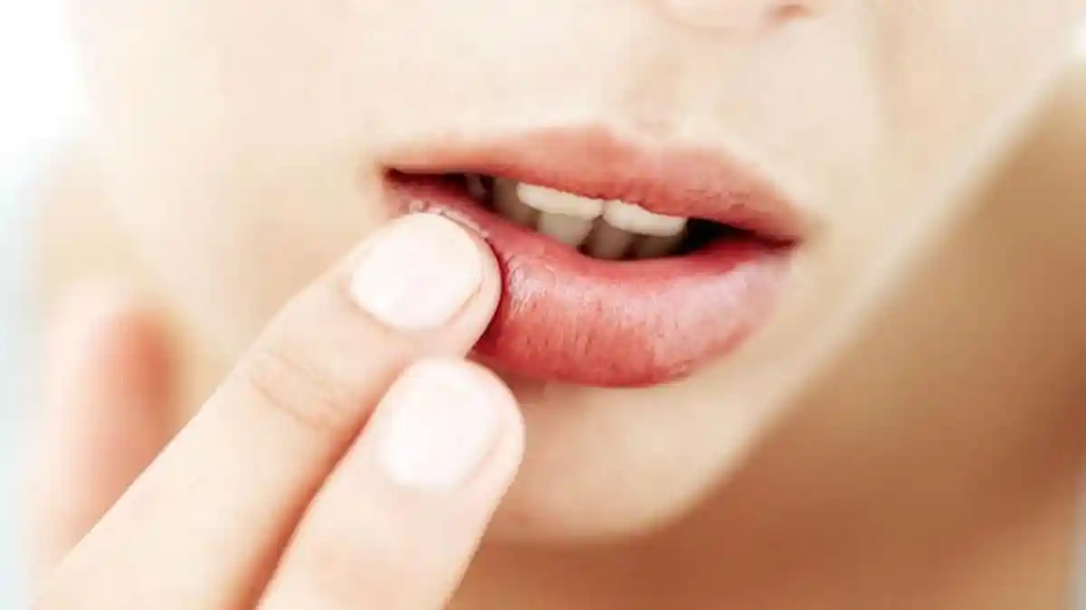 Cara Menjaga Bibir Agar Tidak Hitam Dengan 5 Bahan Alami Ini, Auto Cerah