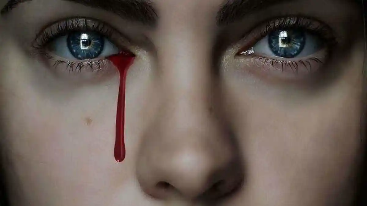 Wanita di India Menangis Darah Selama Menstruasi, Terungkap Pemicunya