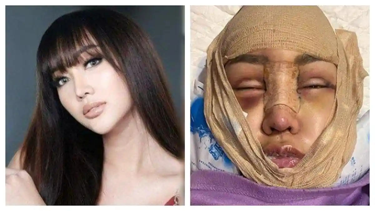 Potret Wajah Lucinta Luna Pasca Banyak Operasi Plastik, Disebut Sudah Mirip Jisoo Blackpink