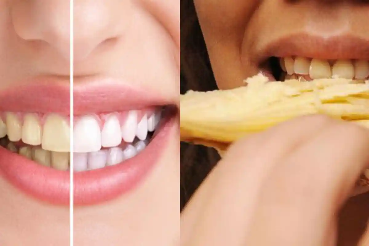 Manfaat Kulit Pisang yang Jarang Diketahui, Ternyata Bisa Digunakan Sebagai Obat Jerawat