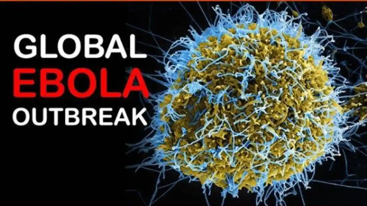 Simak Gejala yang Ditimbulkan Virus Ebola: Demam, Nyeri, Kelelahan hingga Masalah Pencernaan