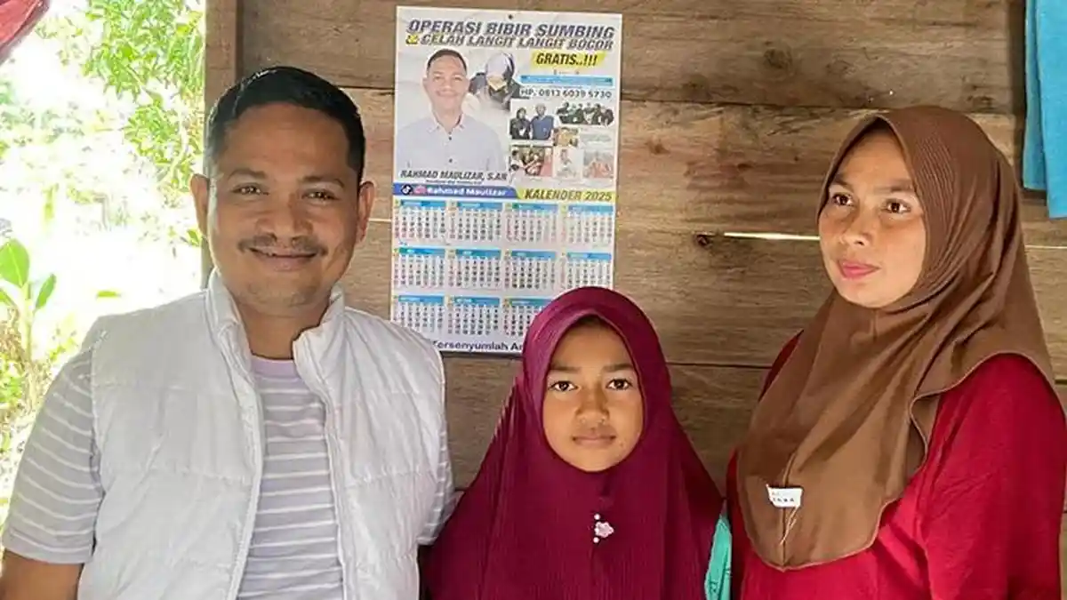 Rahmad Maulizar Bantu Operasi Pasien Celah Langit Bocor asal Aceh Jaya, Butuh Bantuan Hubungi Ini